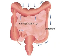 colon-irritable02