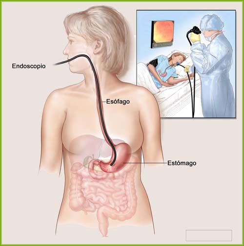 endoscopia01