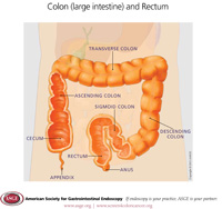 tijuana-gastric-balloon-segmentos-anatomico-colon-min